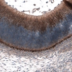 Immunohistochemical staining of mouse eye, retina shows moderate positivity.