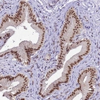 Anti-SMN1 Antibody