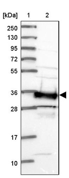 Anti-SMN1 Antibody