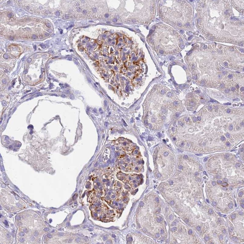 Anti-UBXN2B Antibody