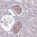 Anti-UBXN2B Antibody