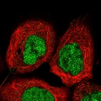 Immunofluorescent staining of human cell line A-431 shows localization to nucleoplasm.