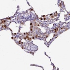Immunohistochemical staining of human lung shows high expression.
