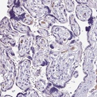 Immunohistochemical staining of human placenta shows low expression as expected.