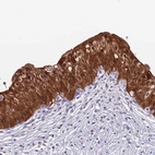 Anti-C6orf47 Antibody