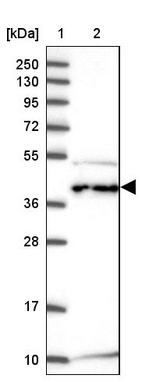Lane 1: Marker [kDa] 250, 130, 95, 72, 55, 36, 28, 17, 10_br/_Lane 2: Human cell line RT-4