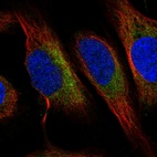 Immunofluorescent staining of human cell line U-2 OS shows localization to cytosol.