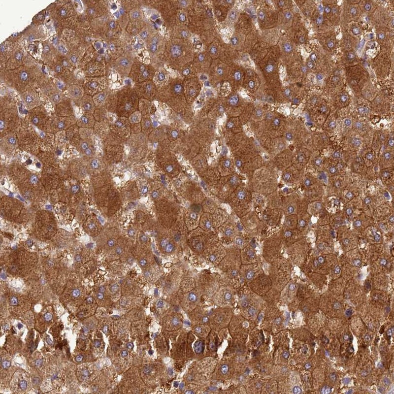 Anti-ADAMTS7 Antibody