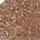 Anti-ADAMTS7 Antibody