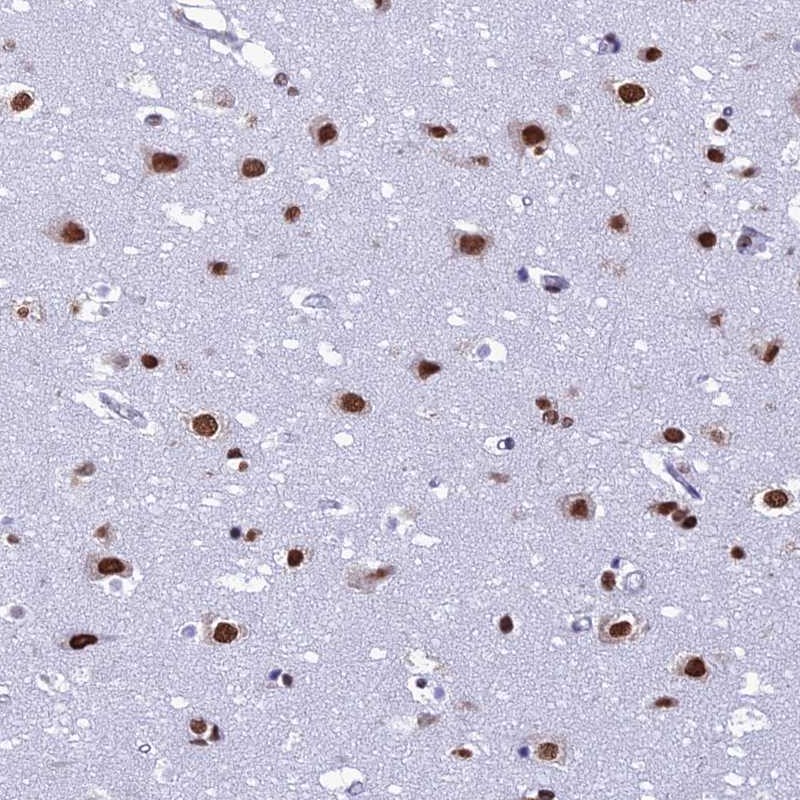 Anti-PRAMEF12 Antibody