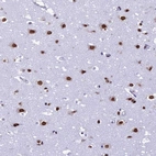 Anti-PRAMEF12 Antibody