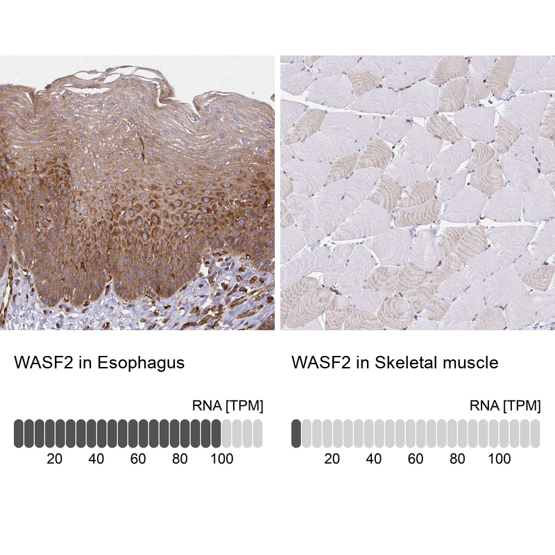 Anti-WASF2 Antibody