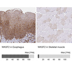 Anti-WASF2 Antibody