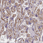 Immunohistochemical staining of human placenta shows strong cytoplasmic positivity in endothelial cells.
