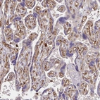 Immunohistochemical staining of human placenta shows strong cytoplasmic positivity in endothelial cells.
