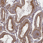 Immunohistochemical staining of human endometrium shows strong cytoplasmic positivity in glandular cells.