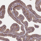 Immunohistochemical staining of human Fallopian tube shows moderate cytoplasmic positivity in glandular cells.