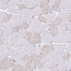Immunohistochemical staining of human skeletal muscle shows low positivity in myocytes as expected.