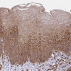 Immunohistochemical staining of human esophagus shows moderate cytoplasmic positivity in squamous epithelial cells.