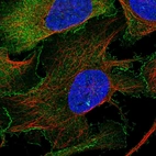 Immunofluorescent staining of human cell line U-2 OS shows localization to plasma membrane.