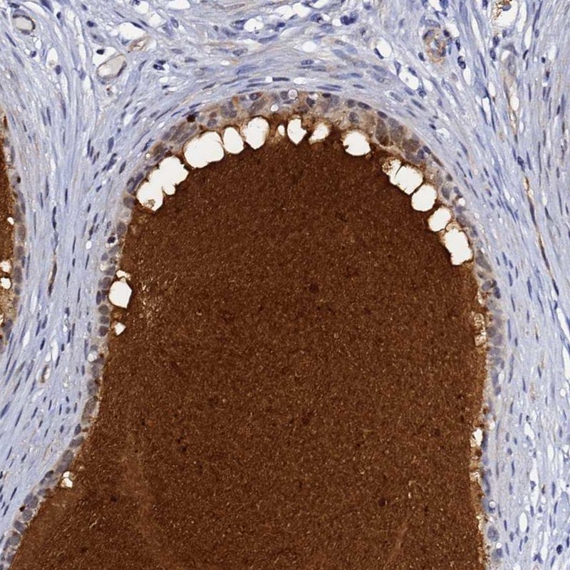 Anti-DEFB104A Antibody