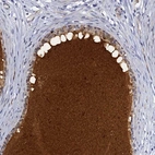 Anti-DEFB104A Antibody