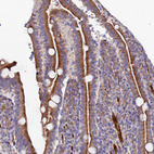 Immunohistochemical staining of human duodenum shows moderate to strong cytoplasmic positivity in glandular cells.