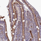 Immunohistochemical staining of human duodenum shows moderate to strong cytoplasmic positivity in glandular cells.