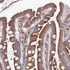 Immunohistochemical staining of human small intestine shows moderate to strong cytoplasmic positivity in glandular cells.