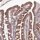 Immunohistochemical staining of human small intestine shows moderate to strong cytoplasmic positivity in glandular cells.