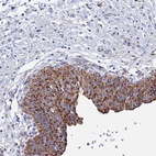 Anti-ANKRD34C Antibody