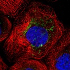 Immunofluorescent staining of human cell line A-431 shows localization to mitochondria.
