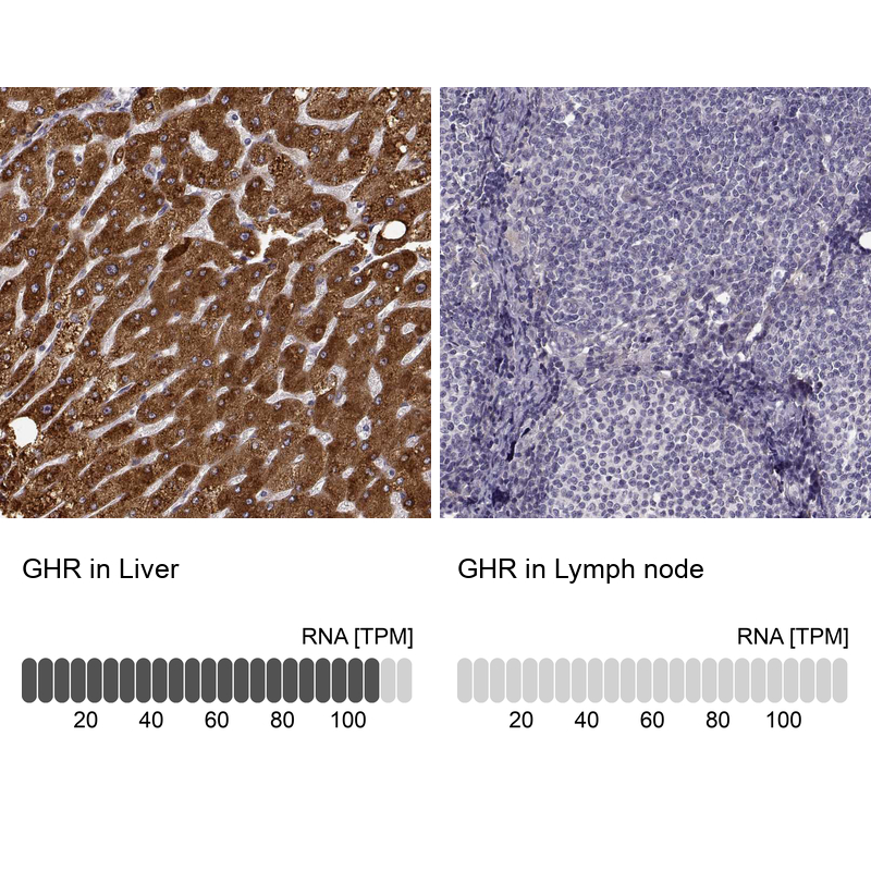 Anti-GHR Antibody