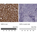 Anti-GHR Antibody