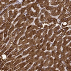Immunohistochemical staining of human liver shows strong cytoplasmic positivity in hepatocytes.