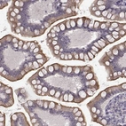 Immunohistochemical staining of human small intestine shows moderate membranous positivity in glandular cells.
