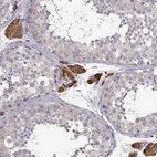 Immunohistochemical staining of human testis shows strong cytoplasmic positivity in Leydig cells.
