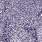 Immunohistochemical staining of human lymph node shows no positivity in non-germinal center cells as expected.