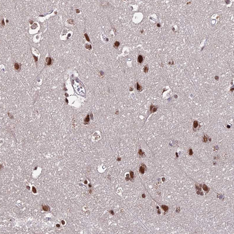 Anti-ZBED4 Antibody