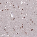 Anti-ZBED4 Antibody