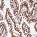 Immunohistochemical staining of human duodenum shows strong nuclear positivity in glandular cells.