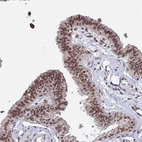 Immunohistochemical staining of human fallopian tube shows strong nuclear positivity in glandular cells.