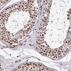 Immunohistochemical staining of human testis shows strong nuclear positivity in cells in seminiferous ducts.