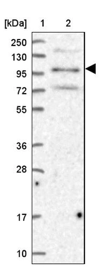 Lane 1: Marker [kDa] 250, 130, 95, 72, 55, 36, 28, 17, 10_br/_Lane 2: Human cell line RT-4