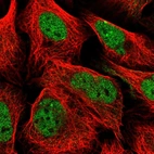 Immunofluorescent staining of human cell line U-2 OS shows localization to nucleoplasm.