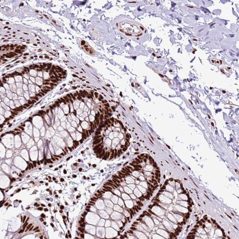 Anti-C6orf226 Antibody