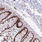 Anti-C6orf226 Antibody