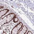 Anti-C6orf226 Antibody