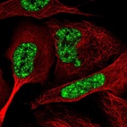 Immunofluorescent staining of human cell line U-2 OS shows localization to nuclear speckles.