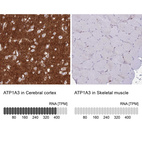 Anti-ATP1A3 Antibody